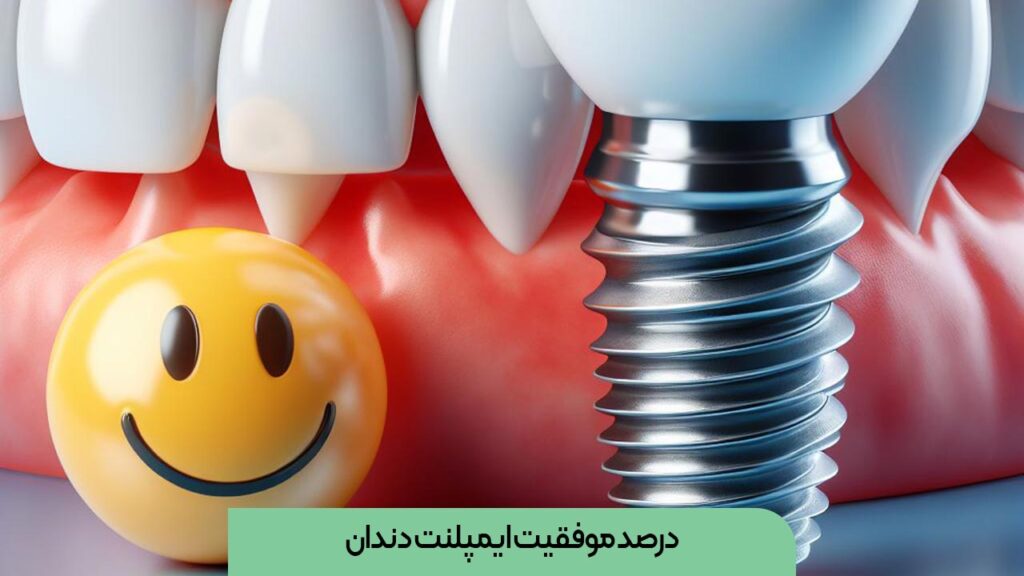 درصد موفقیت ایمپلنت دندان