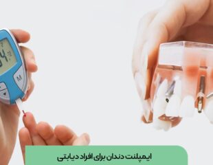 ایمپلنت دندان برای افراد دیابتی