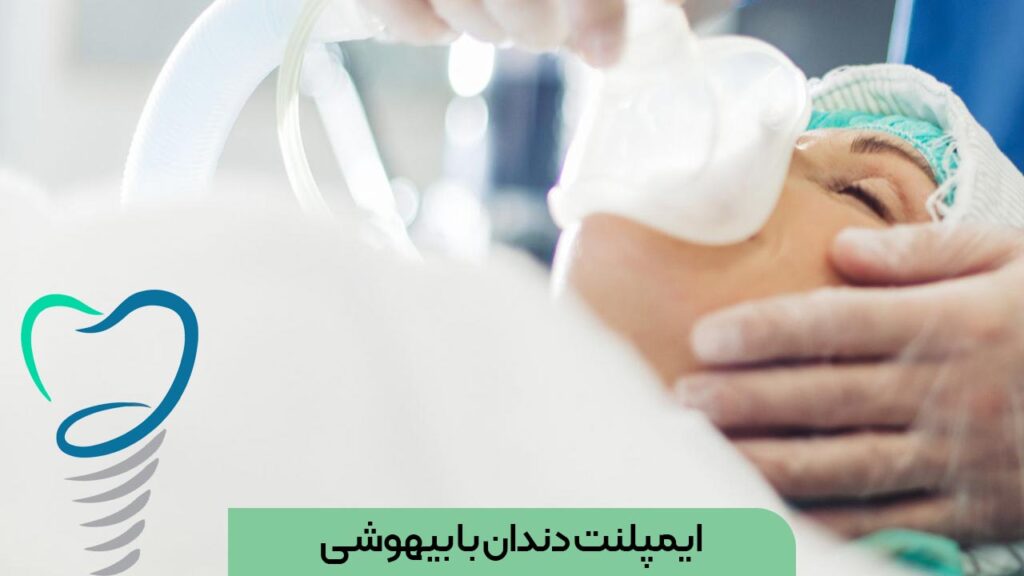 ایمپلنت دندان با بیهوشی