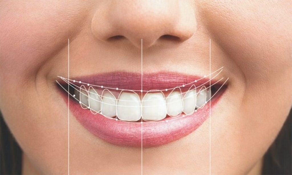 لبخند رضایت از دندانپزشکی دیجیتال